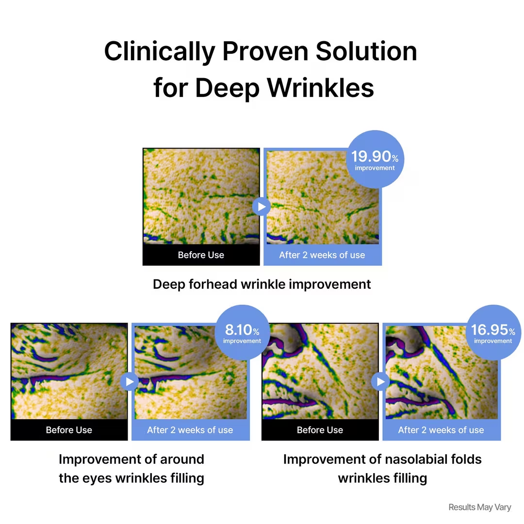 celimax The Vita-A Retinal Shot Tightening Dual Cream – Tighten, Smooth & Transform – Firms & Tightens, Reduces Wrinkles & Smooths Fine Lines