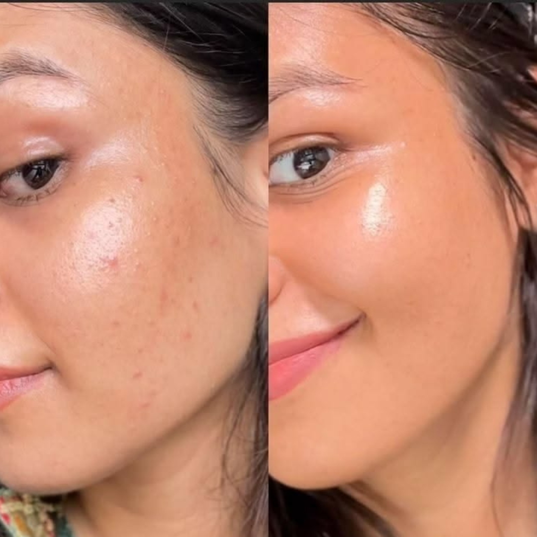 Medicube Kojic Acid Turmeric Night Wrapping Mask – Wake Up to Glowing Skin – Brighten, Even Tone & Overnight Nourishment | Remove Dark Spots & Pigmentation – Peel-Off Mask with Kojic Acid, Turmeric, Vitamin C, Retinol & Collagen