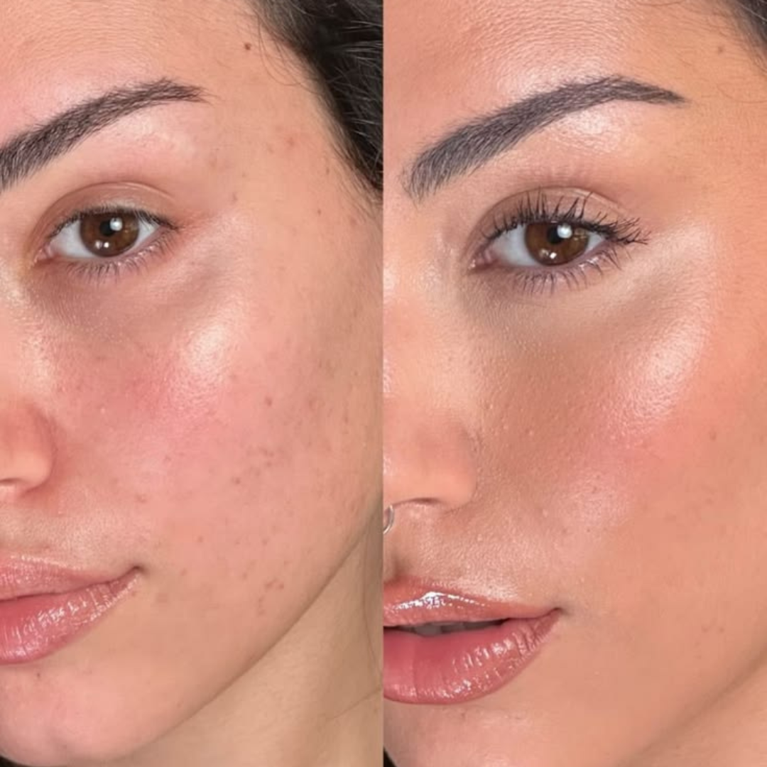 Medicube Kojic Acid Turmeric Night Wrapping Mask – Wake Up to Glowing Skin – Brighten, Even Tone & Overnight Nourishment | Remove Dark Spots & Pigmentation – Peel-Off Mask with Kojic Acid, Turmeric, Vitamin C, Retinol & Collagen