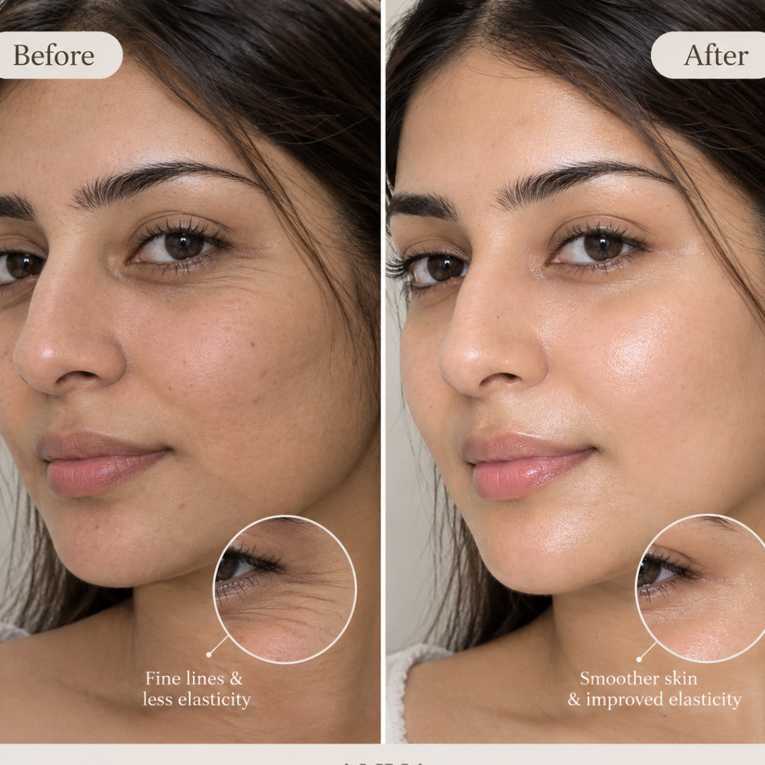 Anua PDRN Hyaluronic Acid Mist & Collagen Melting Patch Duo – Intense Hydration Glass Skin Care Set - Instant tighten skin & give glow