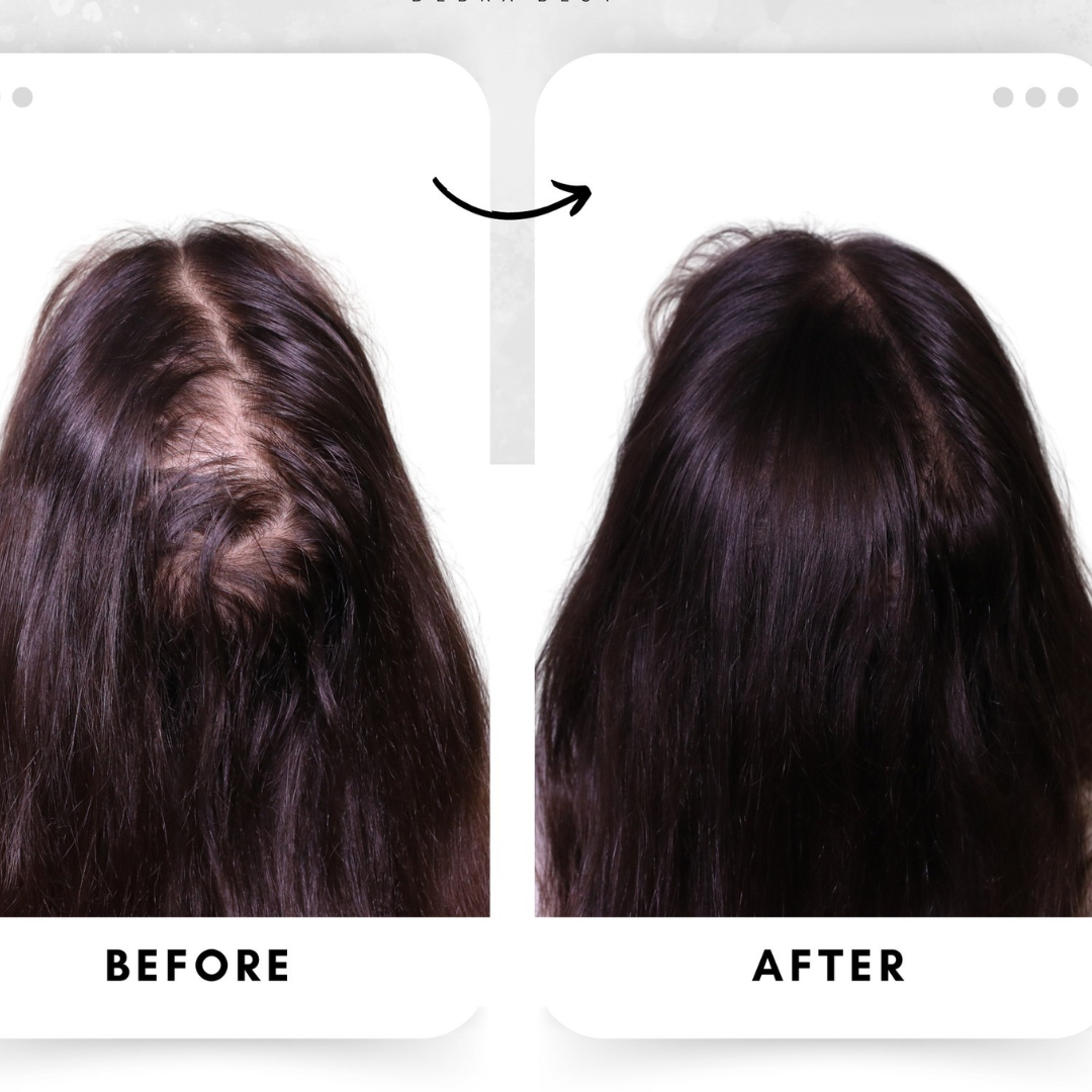 The Ordinary Multi-Peptide Serum for Hair Density – Thicker, Stronger & Healthier Hair – Promotes Hair Growth, Strengthens Strands & Improves Density