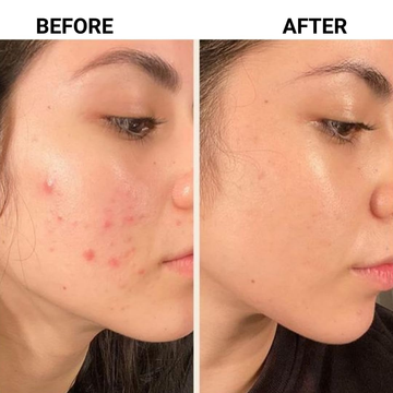 Muse Labs 7% Glycolic Acid Toner | Gentle AHA Exfoliant with Niacinamide & Aloe Vera | Smooth, Bright & Clear Skin