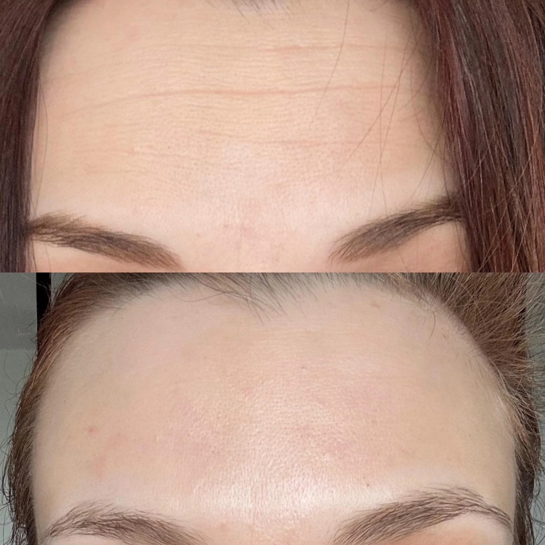 celimax The Vita-A Retinal Shot Tightening Dual Cream – Tighten, Smooth & Transform – Firms & Tightens, Reduces Wrinkles & Smooths Fine Lines