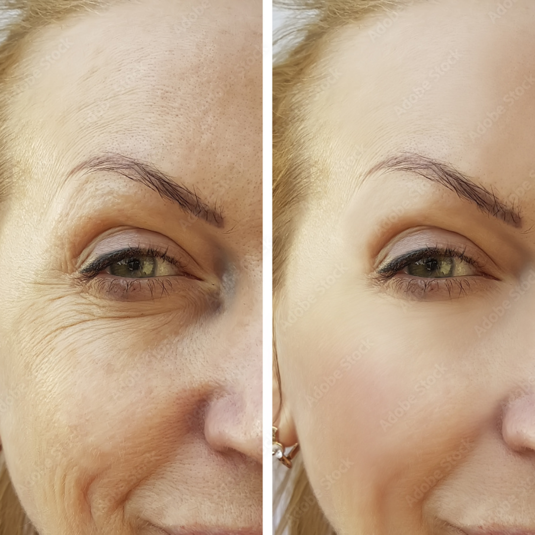 celimax The Vita-A Retinal Shot Tightening Dual Cream – Tighten, Smooth & Transform – Firms & Tightens, Reduces Wrinkles & Smooths Fine Lines