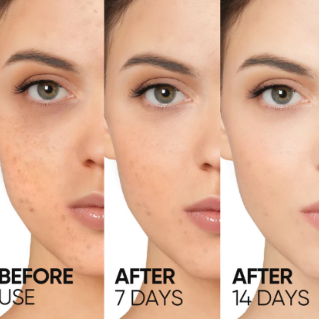 RENEE Immortal Face Cream | All-in-One Moisturizer | Nourishes, Repairs, Renews & Protects | Remove pigmentation, dark spots & brighten skin tone | For All Skin Types