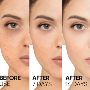 RENEE Immortal Face Cream | All-in-One Moisturizer | Nourishes, Repairs, Renews & Protects | Remove pigmentation, dark spots & brighten skin tone | For All Skin Types