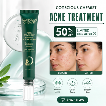 Conscious Chemist Acne Treatment Serum – Reduces Acne, Clears Spots, Smooths Skin – For Acne-Prone Skin