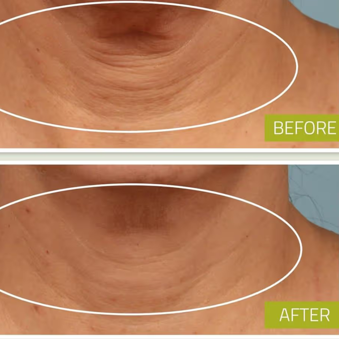 Hakim Suleman's Stretch Mark & Scar Removal Cream | Enriched with Almond, Olive & Sandalwood Oil | Reduces Stretch Marks, Scars & Improves Skin Elasticity