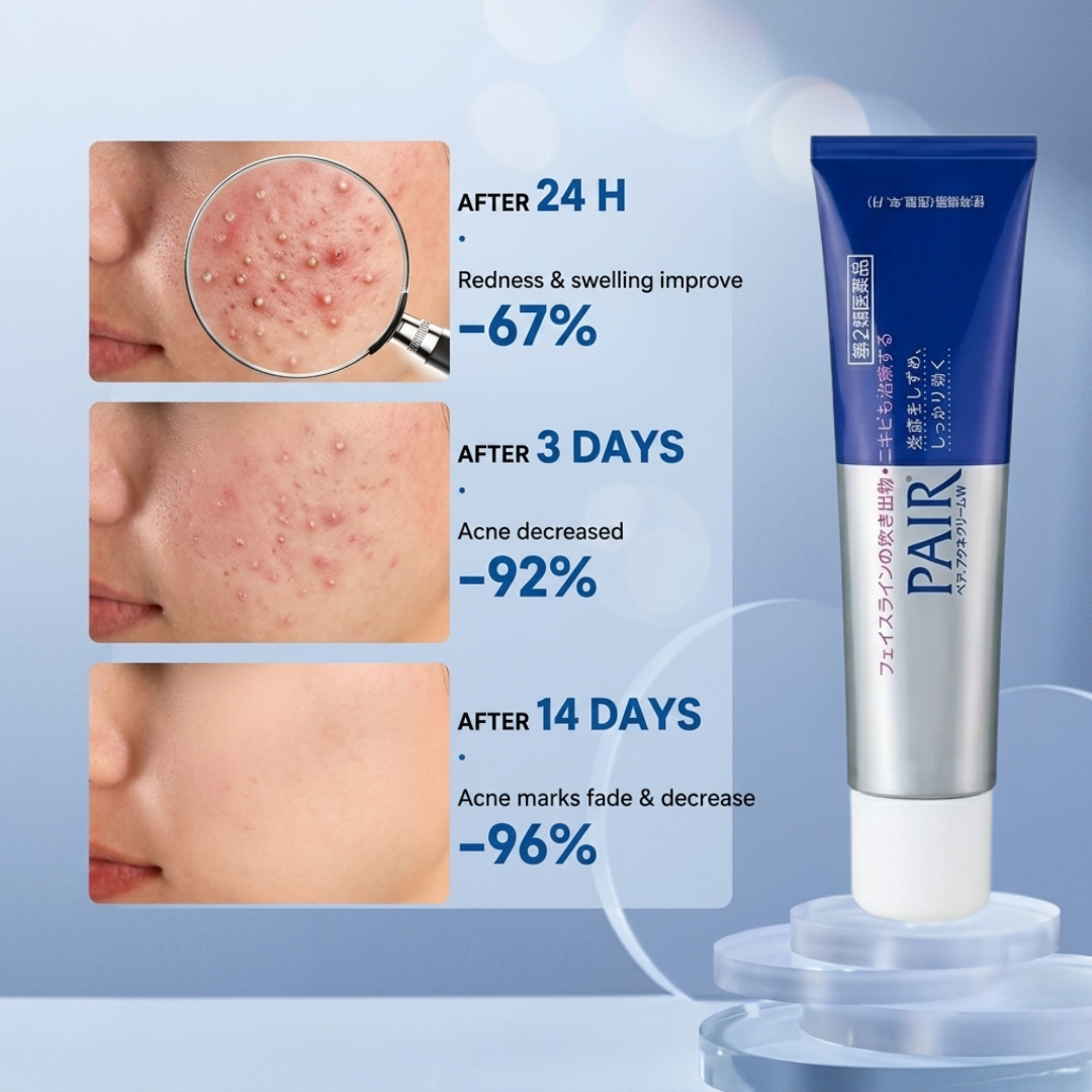 PAIR Acne Cream – Clears Acne, Fades Redness, Prevents New Breakouts – IPPN + IPMP Dual Action – Gentle, Non-Greasy, Dermatologically Tested