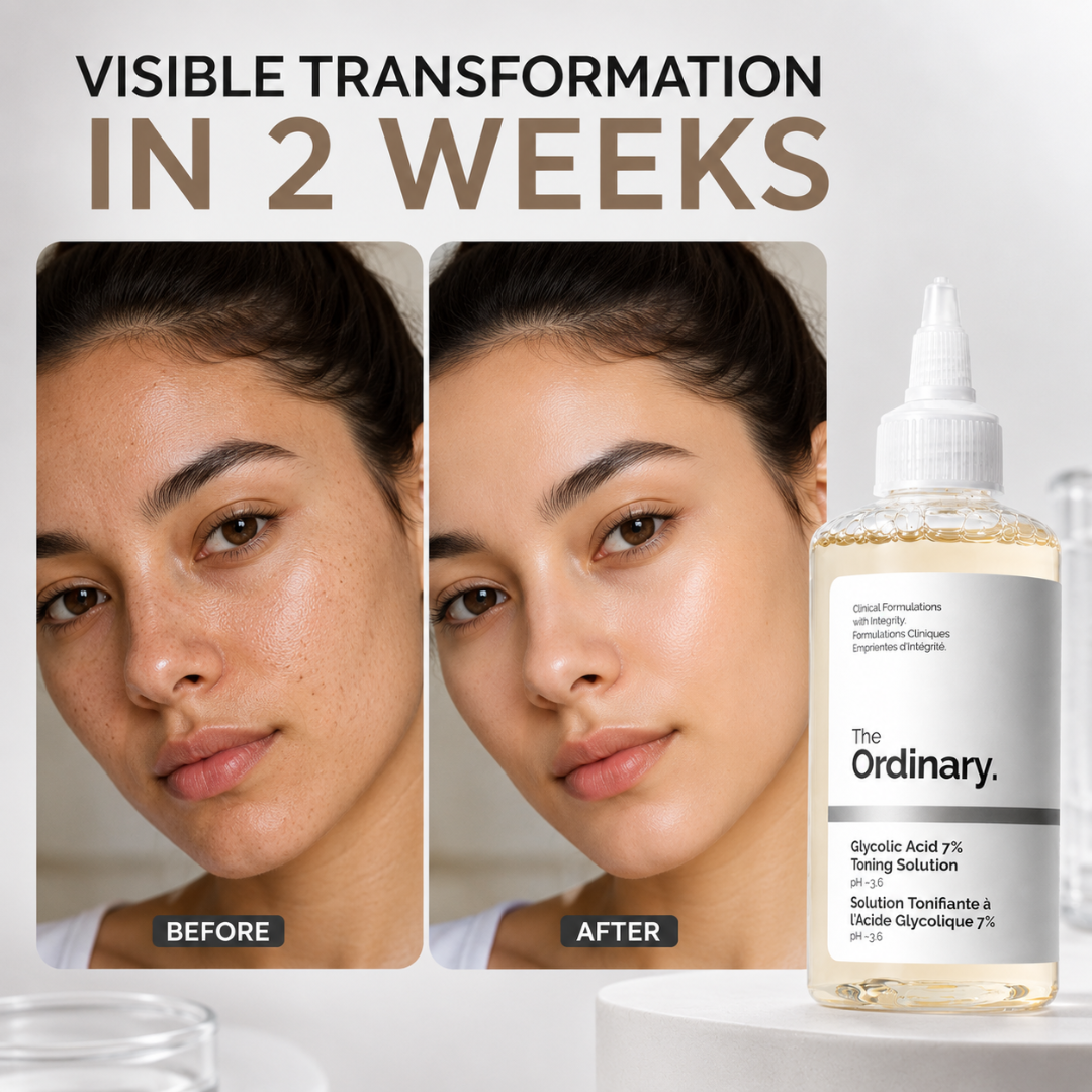 The Ordinary Glycolic Acid 7% Toning Solution – 50% OFF – Reveal Your Smoothest, Brightest Skin – Exfoliates Dead Skin Cells, Brightens Complexion, Unclogs Pores – With 7% Glycolic Acid