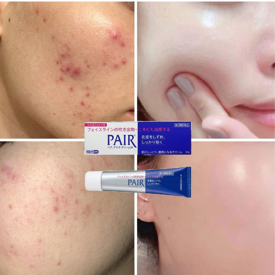 PAIR Acne Cream – Clears Acne, Fades Redness, Prevents New Breakouts – IPPN + IPMP Dual Action – Gentle, Non-Greasy, Dermatologically Tested