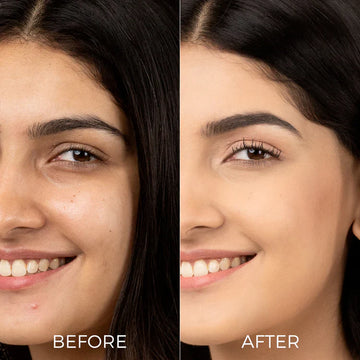 The Muse Labs C-Bright Serum | Brighter, Smoother & Even-Toned Skin in Just 3 Days